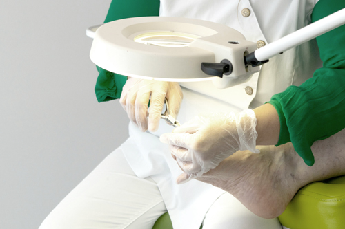 podolog przeprowadzający zabieg z paznokciem szponowatym